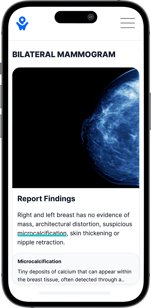 Smartphone showing an image and report findings for a bilateral mammogram.