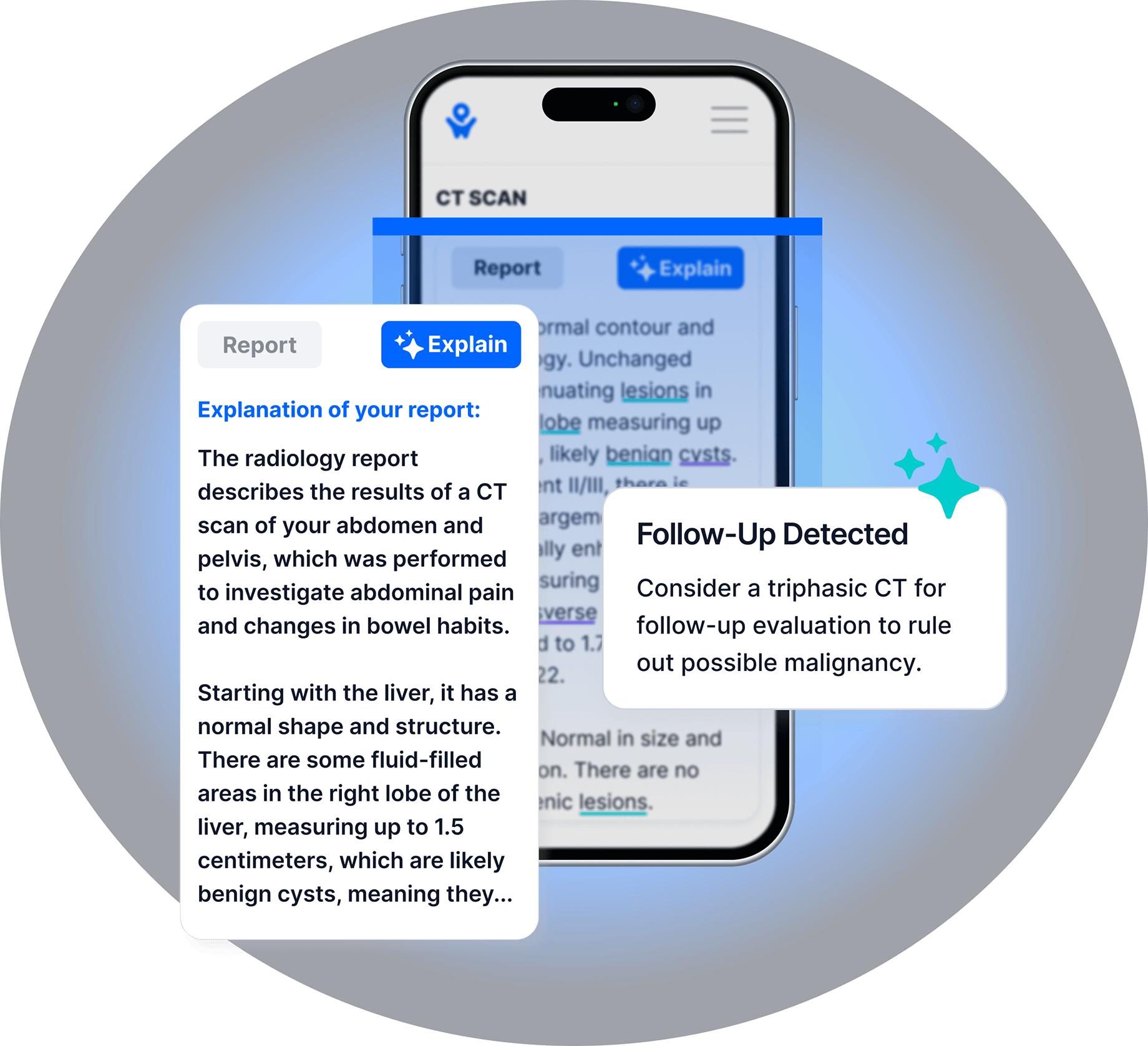 PocketHealth platform shows a CT scan report with two pop-outs showing the report explanation feature and the follow-up feature.