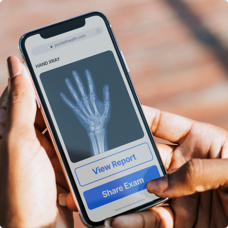 A close-up photo of a hand holding a smartphone. The phone's screen displays an X-ray image of a hand and a portion of a button that says View Report.