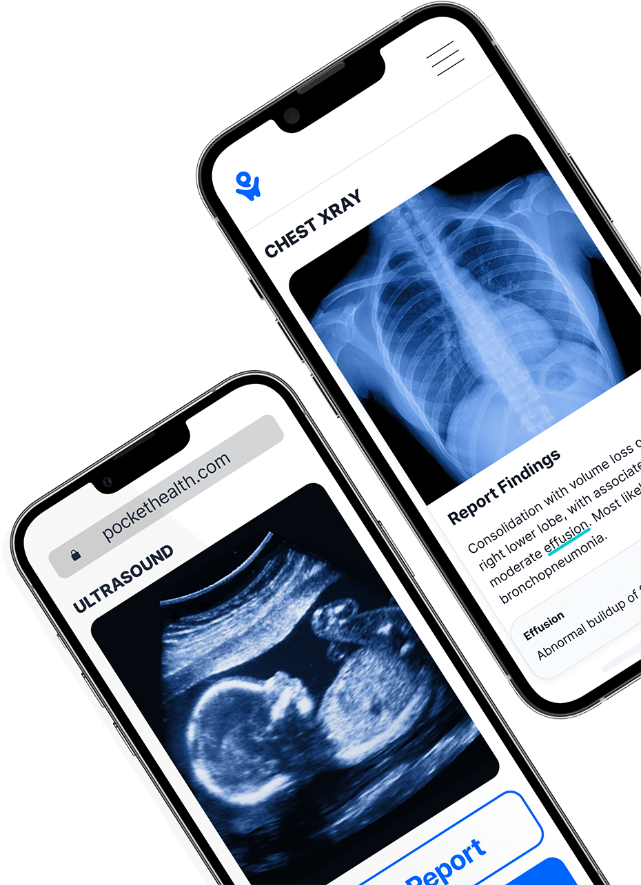 Access imaging and reports using PocketHealth on a phone