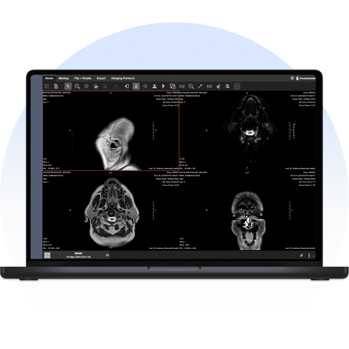 Laptop screen shows four medical images. 