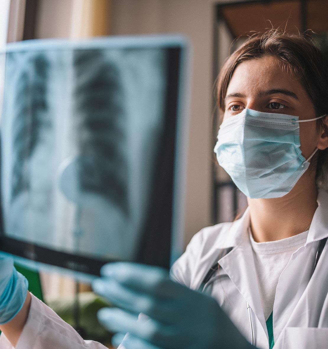 Female medical professional assessing x-ray imaging