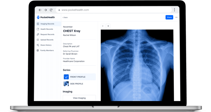 Access imaging and reports using PocketHealth on a laptop