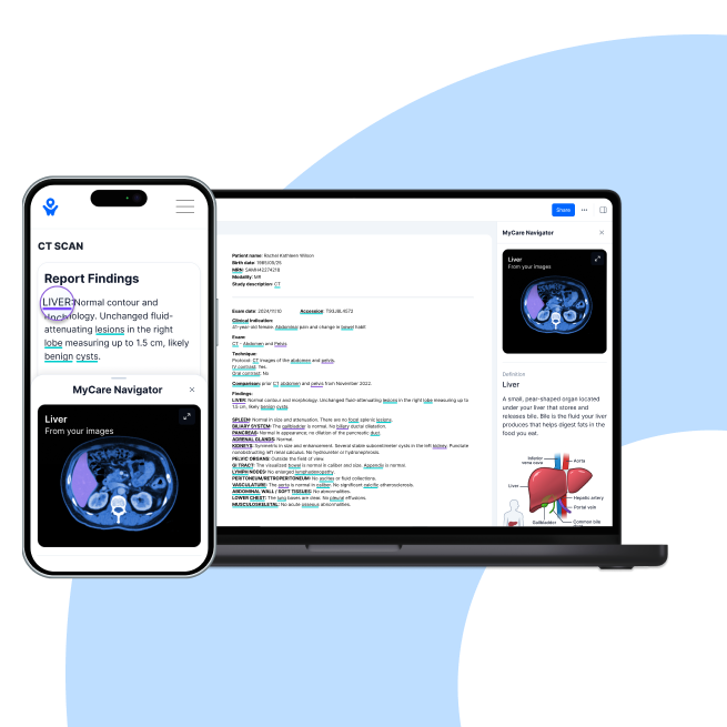 Phone and laptop display imaging and report from a CT scan; the laptop also includes a liver illustration.
