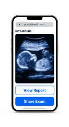 Ultrasound Results