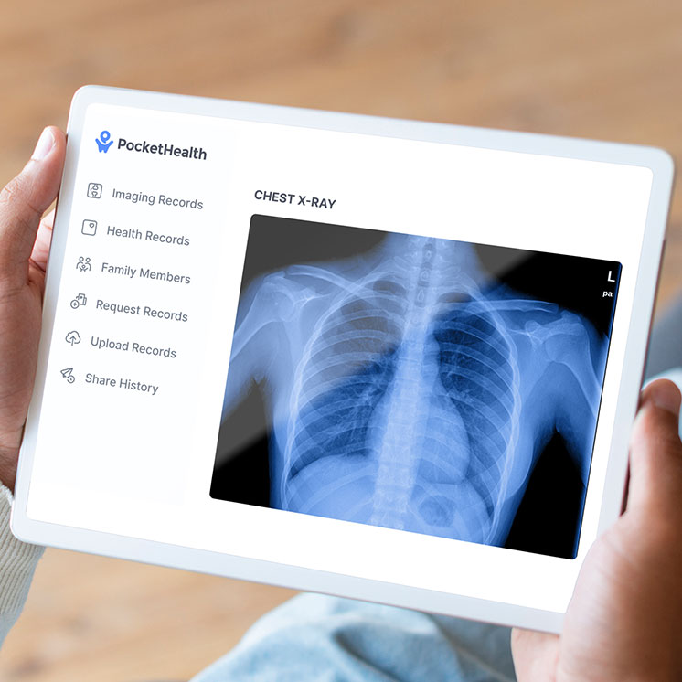 person holding a tablet with imaging report