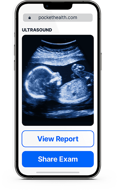 A smartphone displays a list of imaging records, followed by a screen showing an ultrasound.