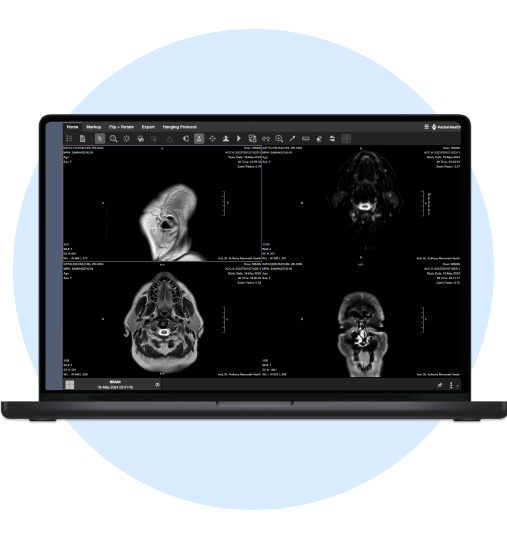Laptop screen shows four medical images. 