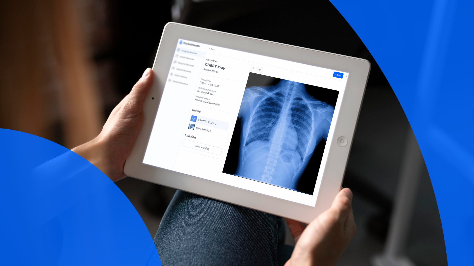 Accessing Your Medical Imaging Records Virtually PocketHealth