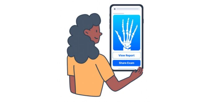 Illustration of woman looking at hand x-ray on mobile device