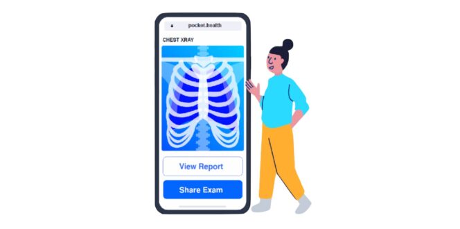 Illustration of x-ray on mobile device