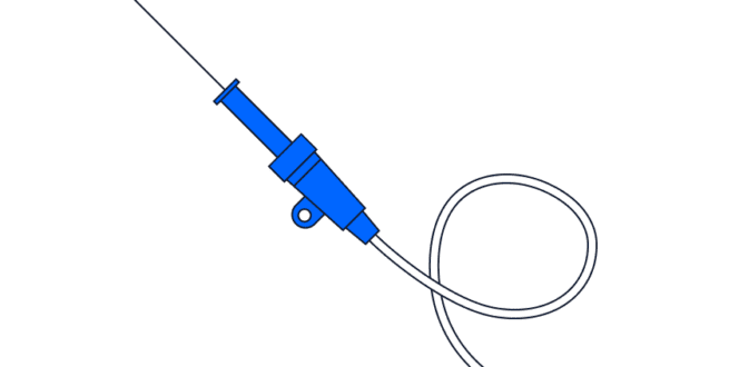 angiogram illustration