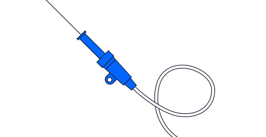 angiogram illustration