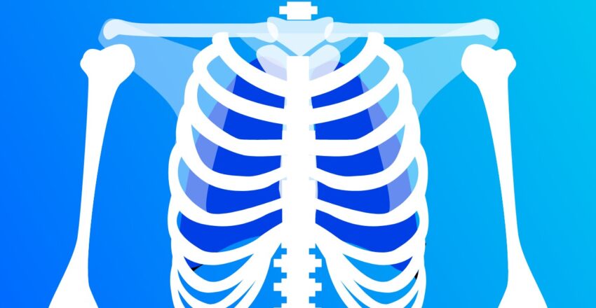 Illustration of torso x-ray