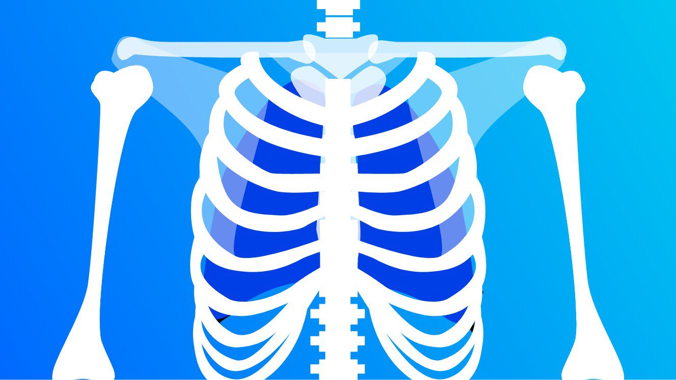 A radiologist’s guide to getting an MRI PocketHealth