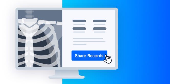 share records screen