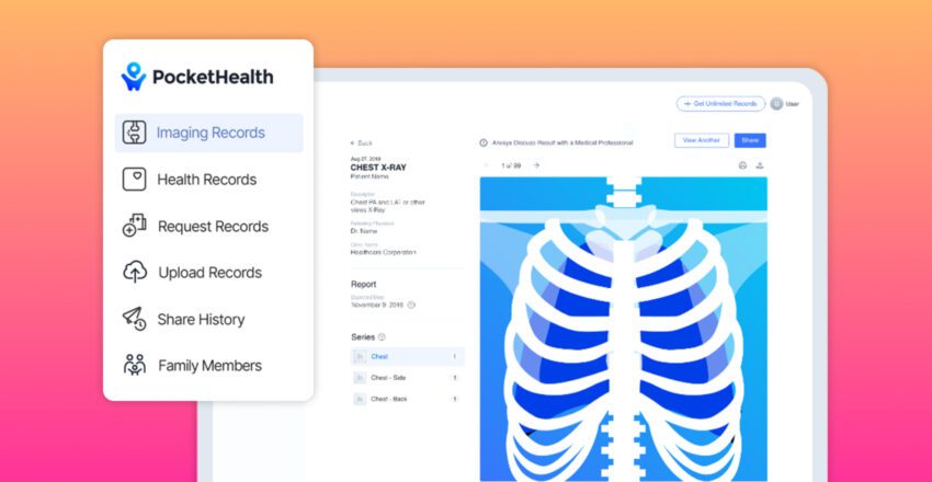 Imaging records of a chest x-ray on PocketHealth account