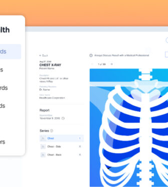 PocketHealth imaging records and chest X-ray scan on desktop