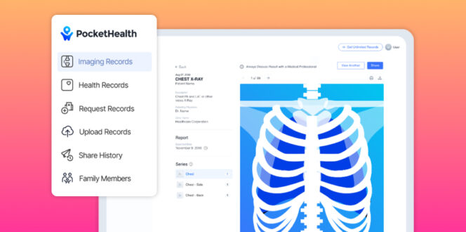 PocketHealth imaging records and chest X-ray scan on desktop