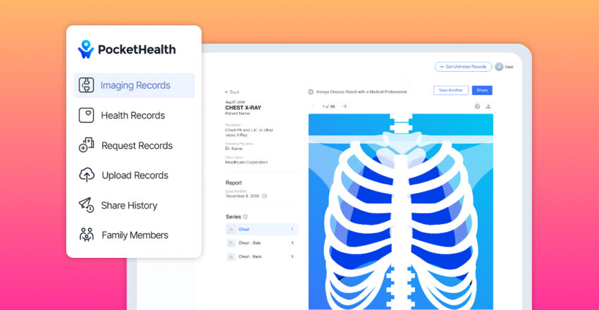 PocketHealth imaging records and chest X-ray scan on desktop