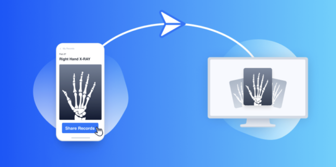 pockethealth X-ray of hand on mobile and desktop