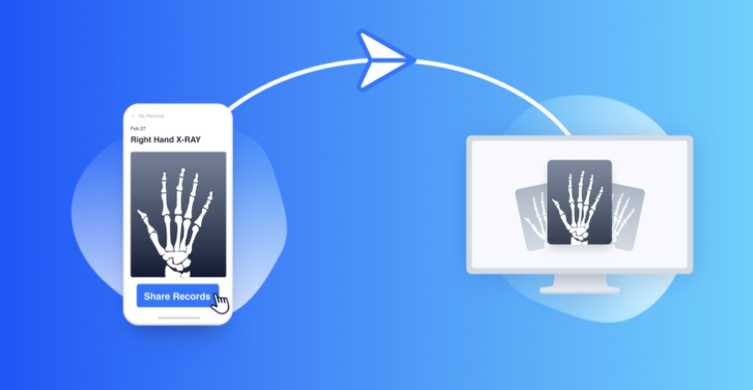 pockethealth X-ray of hand on mobile and desktop