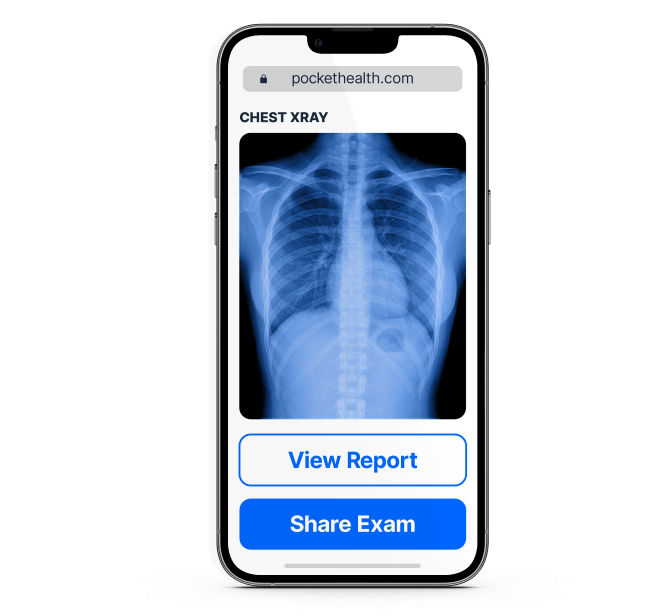 image of PocketHealth on mobile device