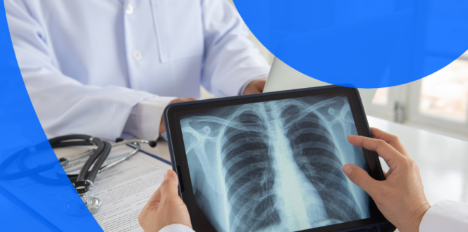 Lung CT Scan on a tablet