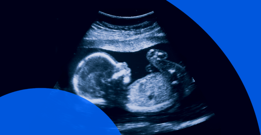 pregnancy ultrasound report