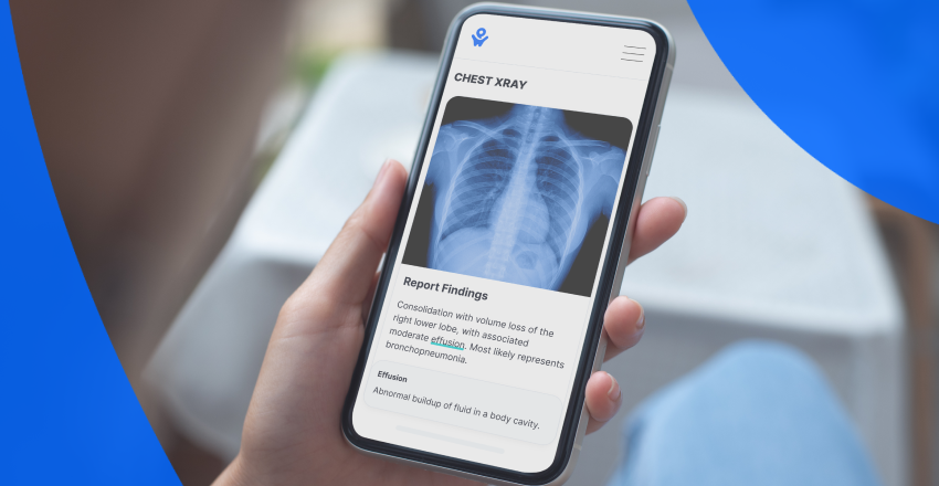 A person viewing an x-ray report on their phone using PocketHealth