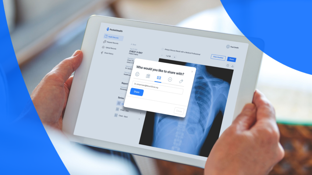 Patient uses PocketHealth to access and share their X-ray report