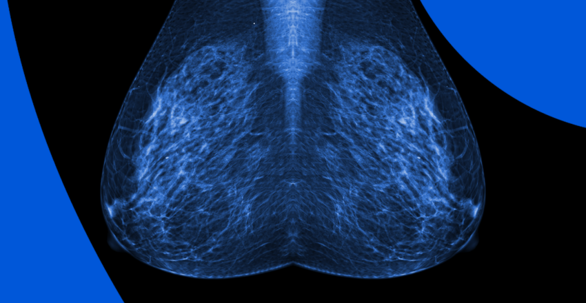 Mammogram original