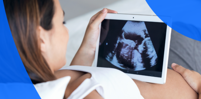 Pregnancy Ultrasound