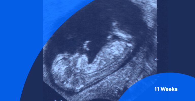 11-Week Ultrasound: Pictures, Fetus Size & What to Expect