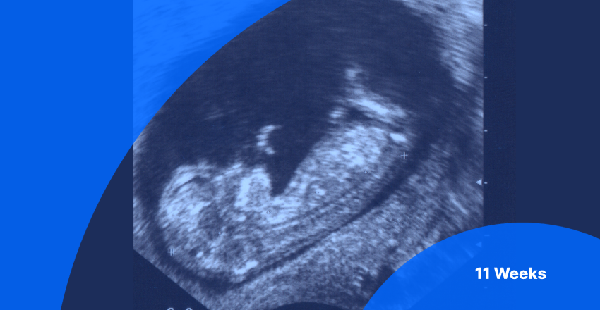 11 Weeks Pregnant Ultrasound Image of Fetus