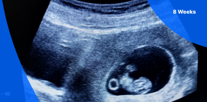 8 weeks pregnant ultrasound image