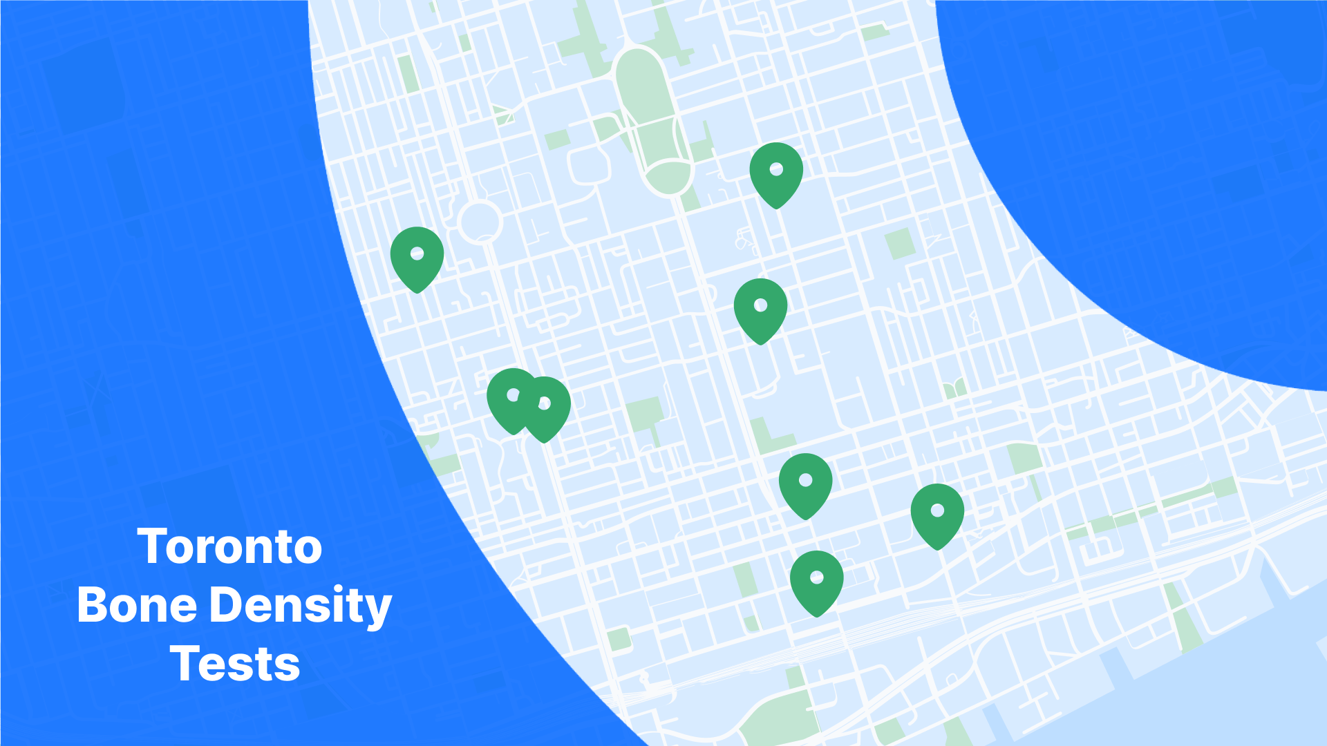 Getting a Bone Density Test in Toronto? | PocketHealth