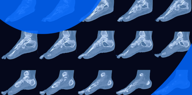 Can I See My CT Scan Results Online?