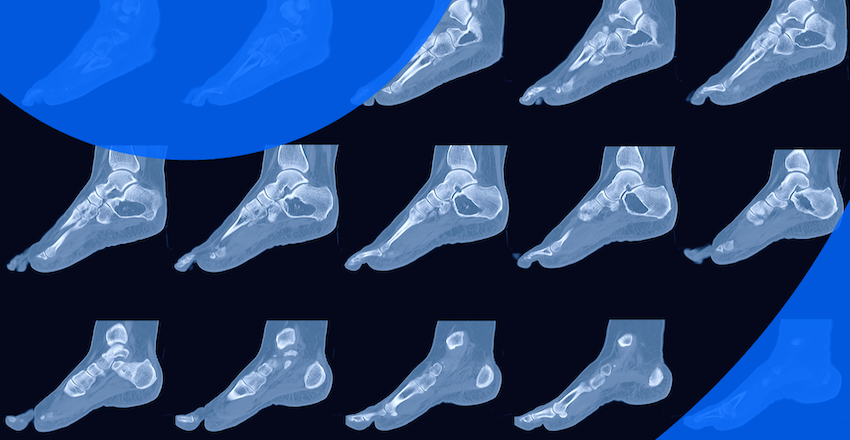 Can I See My CT Scan Results Online?