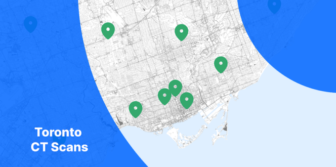 Toronto CT Scan Map