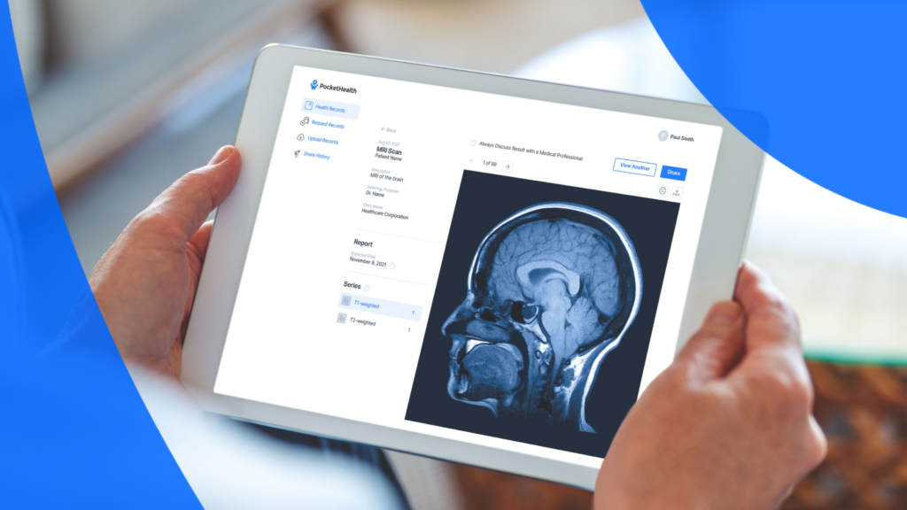 Patient using PocketHealth to access their MRI report online