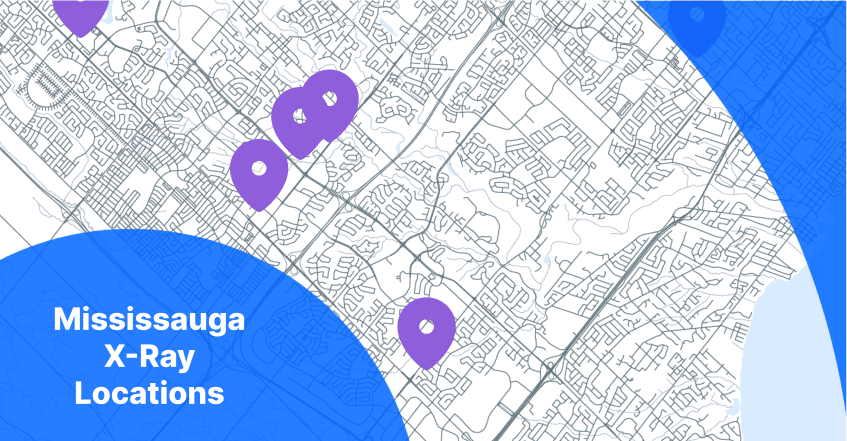 X-Ray Mississauga Map