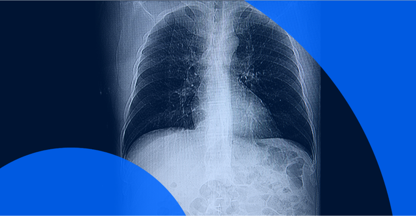 How to Read a CT Scan Report