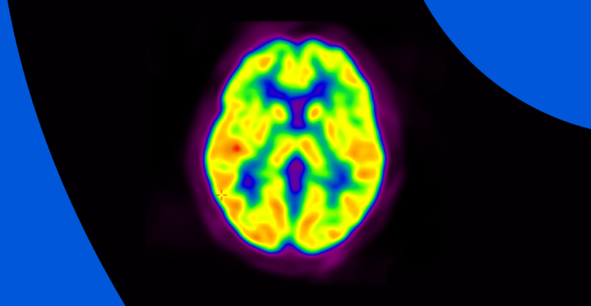 Can I See My PET Scan Results Online? | PocketHealth