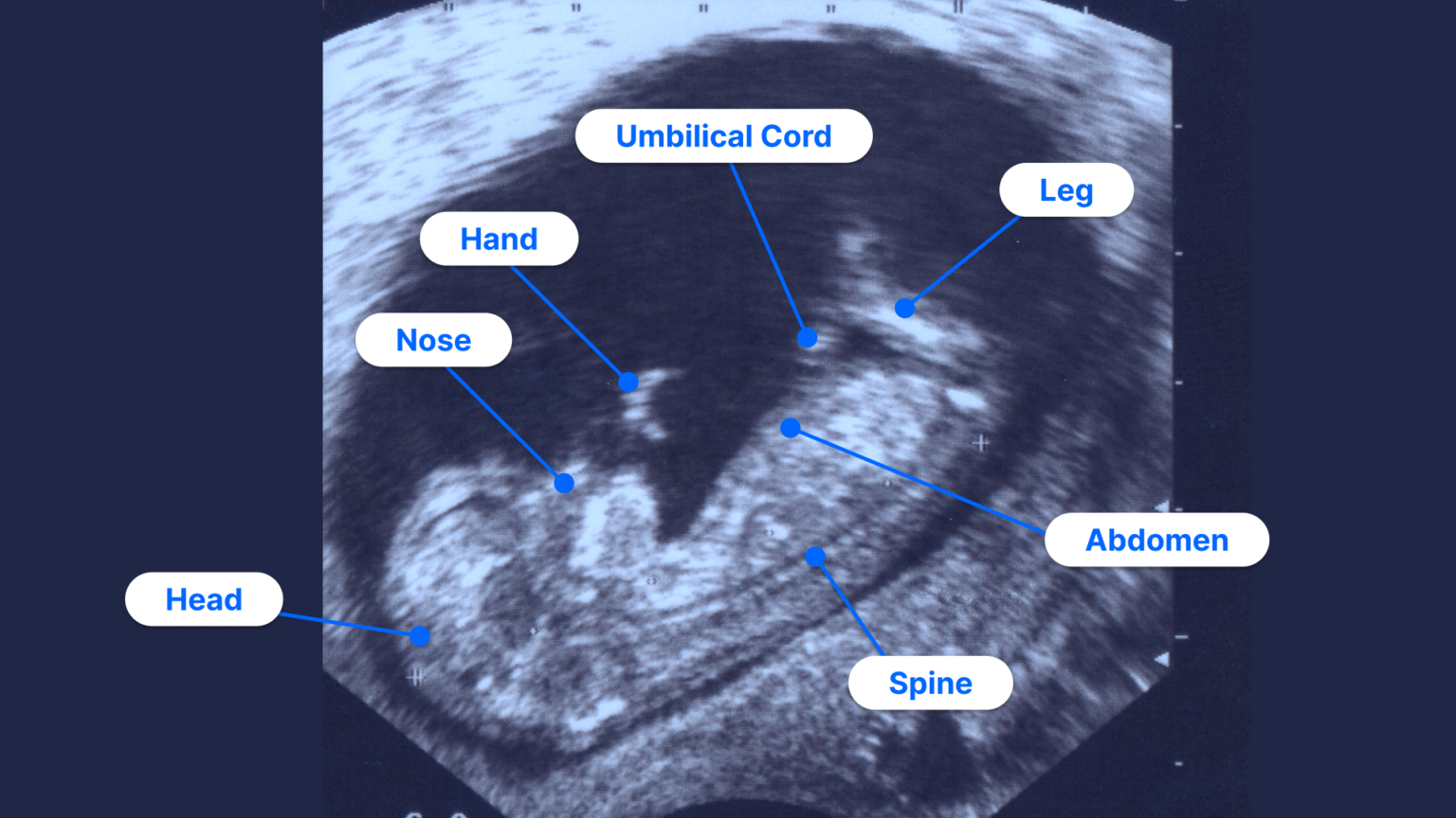 How to Read an Ultrasound Colors, Numbers and Abbreviations