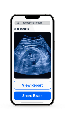 Ultrasound Results