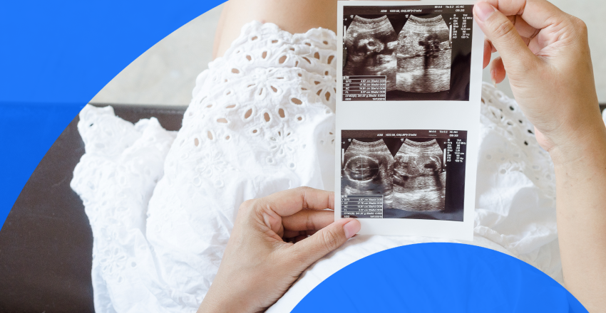 A pregnant woman getting an ultrasound scan