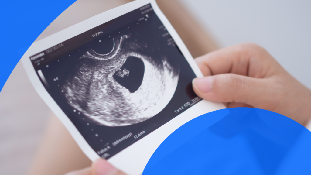A woman looking at a 6-week ultrasound image