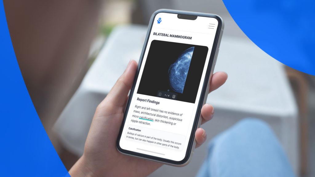 Patient reviewing their Mammogram report using PocketHealth