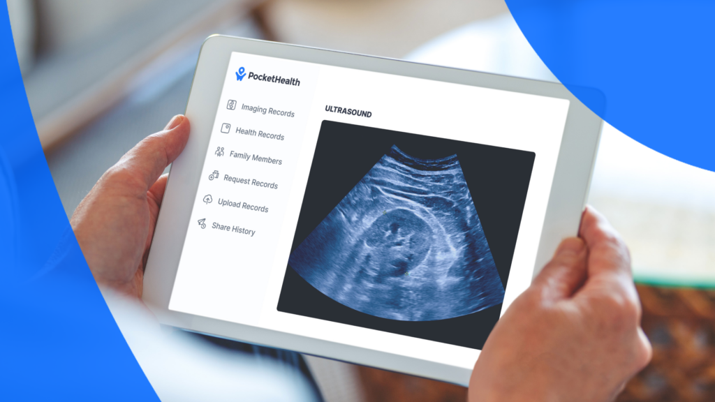 A patient uses PocketHealth to check their ultrasound reports
